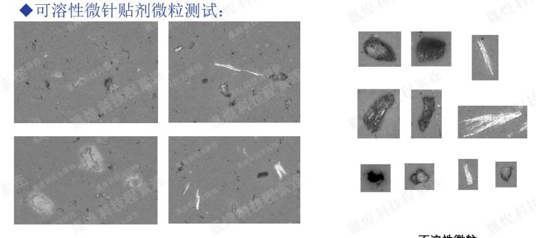 111300_447165_jswz.jpg 可溶性微针贴剂